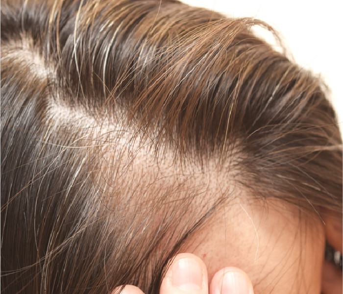 分け目、つむじが気になる