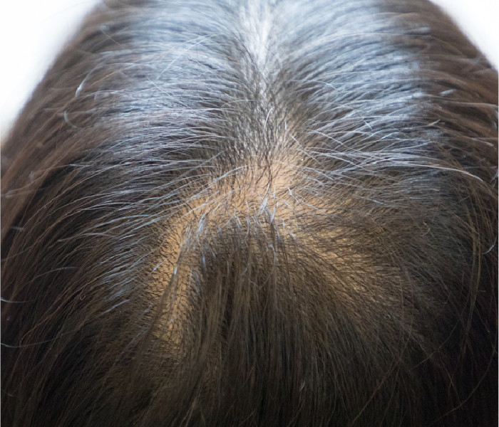 地肌の透け感が気になる